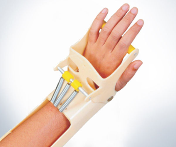 Cock%20Up%20Splint%20Dynamic%20-%20Image%203