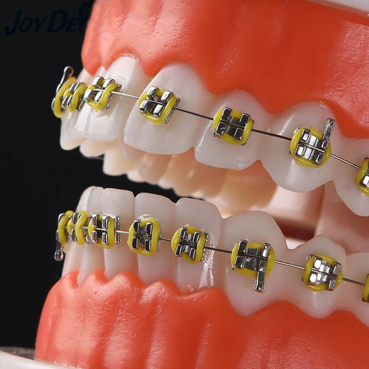 Dental Orthodontic Teeth Model With Metal Braces School Teaching ...