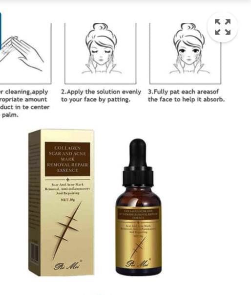 Original%20Scar%20and%20Acne%20Mark%20Removal%20Gel%20Stretch%20Marks/acne/scald/surgical%20Scars%20Treatment%20Cream%20Skin%20Care%20-%20Image%209