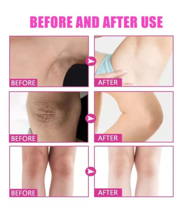 Kormesic%20Kojic%20Acid%20And%20Collagen%20Underarm%20Cream%2050ml%20-%20Image%202