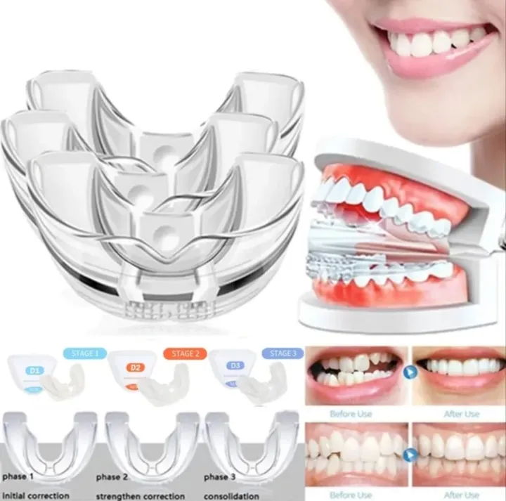 DealSpot%20Dental%20Orthodontic%20Teeth%20Corrector%20Braces%20%7C%20Removable%20Teeth%20Retainer%20&%20Alignment%20Trainer%20Tool%20%7C%20Reusable%20Dental%20Straightening%20Device%20for%20Oral%20Care,%20Smile%20Support%20(Adults%20&%20Teens)%20-%20Image%203
