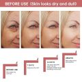 Ordinary Peeling Solution AHA 30% + BHA 2%, 1 Fl Oz Face Serum 30ml. 