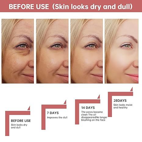 Ordinary%20Peeling%20Solution%20AHA%2030%25%20+%20BHA%202%25,%201%20Fl%20Oz%20Face%20Serum%2030ml%20-%20Image%204