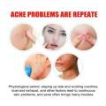 Pimple Patches for Face, Cute Star Zit Covers, Stars Hydrocolloid Acne Patch. 