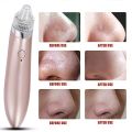 Blackhead Remover Vacuum Tool Stick Machine Kit Pore Cleaner Acne & Blemishes. 