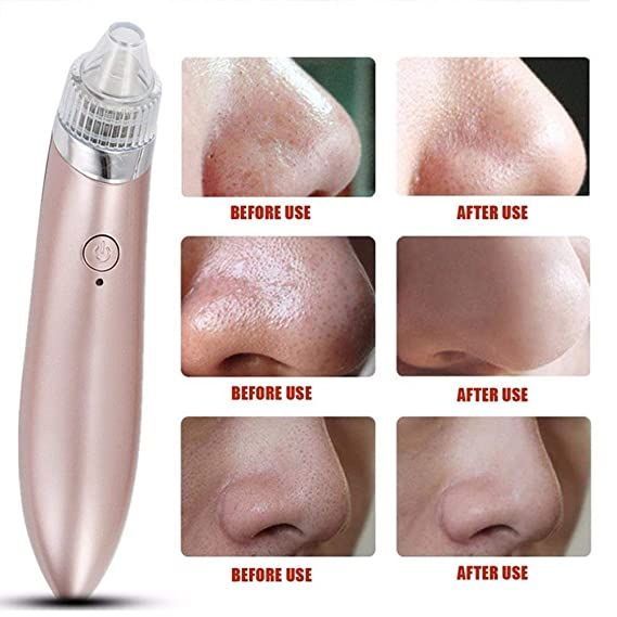 Blackhead%20Remover%20Vacuum%20Tool%20Stick%20Machine%20Kit%20Pore%20Cleaner%20Acne%20&%20Blemishes%20-%20Image%203