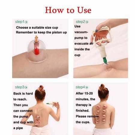 Cupping%20Therapy%20-%20Image%203