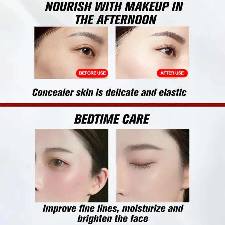 Lethe%20Ling%20%ED%83%9C%EB%B0%98%20%EB%A1%9C%EC%96%84%20%EC%97%90%EC%9D%B4%EC%A7%80%20%EB%93%9C%EB%9E%98%EA%B3%A4%20%EB%B8%94%EB%9F%AC%EB%93%9C%20%ED%81%AC%EB%A6%BC,%20%ED%82%A4%EB%A6%B0%20%ED%9A%8C%EC%B6%98%20%EB%93%9C%EB%9E%98%EA%B3%A4%20%EB%B8%94%EB%9F%AC%EB%93%9C,%20%ED%94%BC%EB%B6%80%20%ED%9A%8C%EB%B3%B5,%20%EA%B8%B0%EB%A6%84%EA%B8%B0%20%EC%97%86%EB%8A%94%20%ED%8E%98%EC%9D%B4%EC%8A%A4%20%ED%81%AC%EB%A6%BC,%20%EC%8B%A0%EC%A0%9C%ED%92%88%20-%20Image%204