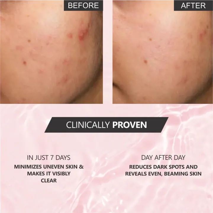 Lords%20AHA%20BHA%20Clarifying%20Treatment%20Toner%20100%20ml%20Korean%20Toner%20-%20Image%203