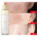 I' m From Rice Toner - 30 ML. 