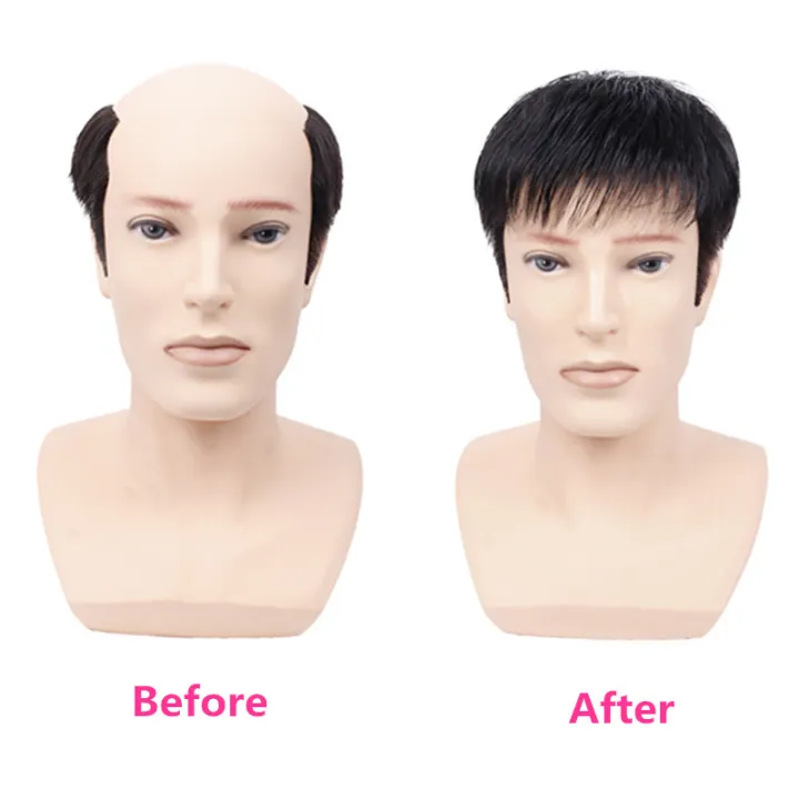 Natural%20Breathable%20Hair%20Extensions%20Synthetic%20Men%20Closure%20Wig%20Piece%20Men's%20Head%20Repair%20Block%20Forehead%20Baldness%20Cover%20Hat%20Wigs%20-%20Image%203