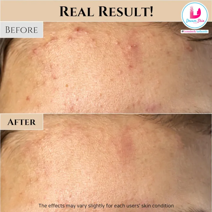 Beauty%20of%20joseon-Ground%20Rice%20and%20Honey%20Glow%20Mask%20%5B150ml%5D%20By%20Dream%20Skin%20Nepal%20-%20Image%206