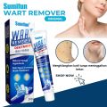Eelhoe Wart Treatment Cream Warts Remover Ointment Skin Tag Removal Men Women -20g. 