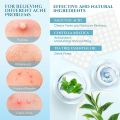 99 Mall Offer 30 PCS Waterproof Salicylic Acid Pimple Patch – Acne Spot Treatment & Skin Repair By 99 Stores. 