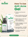 Herbal Aloe Anti Acne Gel 30 Grm. 