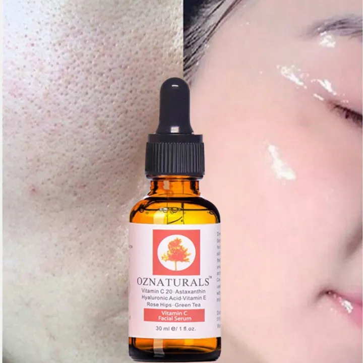 OZ%20Naturals%20Vitamin%20C%20Facial%20Serum%20With%20Hyaluronic%20Acid%20&%20Vitamin%20E%20-30ml%20-%20Image%203