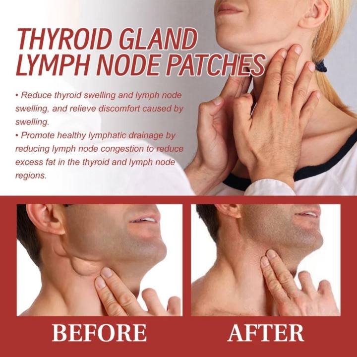 Thyroid%20Gland%20Lymph%20Nodes%20Patch,%20Herbal%20Lymph%20Care%20Patch,%20Neck%20Lymphatic%20Drainage%20Patch%20For%20Dredge%20Neck%20Node%20Swelling%20(7%20Pieces)%20-%20Image%205