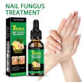 Jaysuing for Treating Gray Nails Nail Care Solution Ginger Essence. 