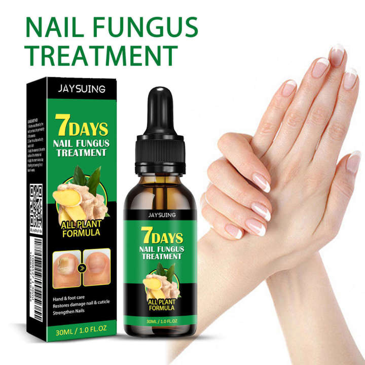 Jaysuing%20for%20Treating%20Gray%20Nails%20Nail%20Care%20Solution%20Ginger%20Essence%20-%20Image%204