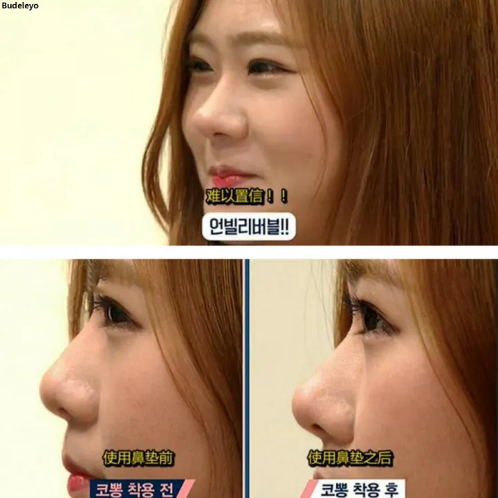 Budeleyo6pc/set%20Beauty%20Nose%20Clip%20Corrector%20Massage%20Tool%20Nose%20Up%20Lifting%20Shaping%20Clip%20Clipper%20Shaper%20Bridge%20Straightening%20No%20Pain%203%20Size%20Luxury%20-%20Image%205