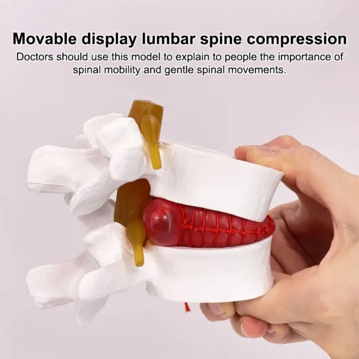 High%20Quality%203D%20Model%20Lumbar%20Model%20Compression%20Demonstration%20.5X%20Enlarge%20Human%20Anatomy%20Skeleton%20Model%20Spinal%20Pressure%20Lesions%20Simulation%20Lumbar%20Disc%20Herniation%20Teaching%20Tool%20Nursing%20-%20Image%204