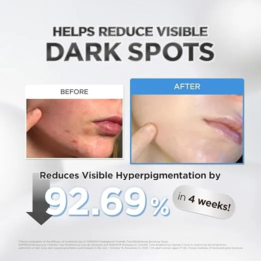 SKIN1004%20Madagascar%20Centella%20Tone%20Brightening%20Capsule%20Ampoule%20100%20ml%20-%20Image%206
