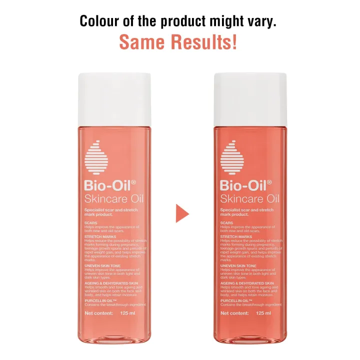 Bio-Oil%20Original%20Skincare%20Oil%20for%20Stretch%20Marks%20&%20Scar%20Removal%20%7C%20125ml%20-%20Image%205
