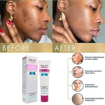 Kojic%20Acid%20and%20Collagen%20Underarms%20Whiting%20Cream%2050ml%20-%20Original%20Genuine%20Underarm%20Cream%20-%20Image%203