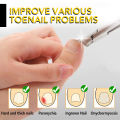Stainless Steel Nail Clippers Trimmer Ingrown Pedicure Care Professional Cutting Tools for Feet Toenail Paronychia Improved. 