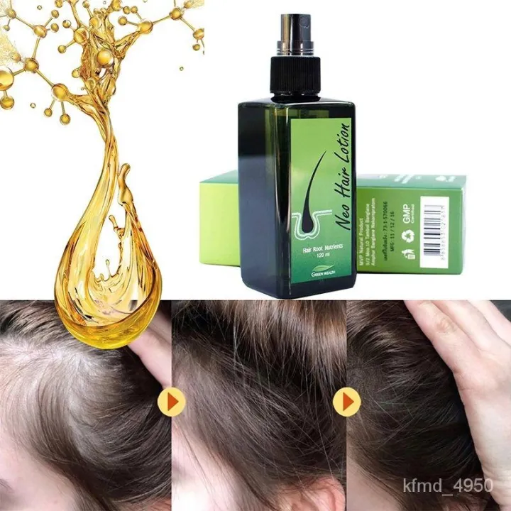 Green%20Wealth%20Neo%20Hair%20Lotion%20-120ml%20-%20Image%205