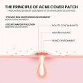 Acne Pimple Master Patch – Transparent Hydrocolloid Spot Treatment for Clear Skin | Korean Beauty Secret (36 Pcs). 