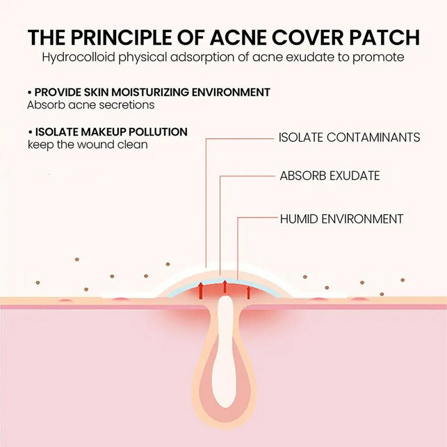 Acne%20Pimple%20Master%20Patch%20%E2%80%93%20Transparent%20Hydrocolloid%20Spot%20Treatment%20for%20Clear%20Skin%20%7C%20Korean%20Beauty%20Secret%20(30%20Pcs%20or%2036%20Pieces)%20-%20Image%209