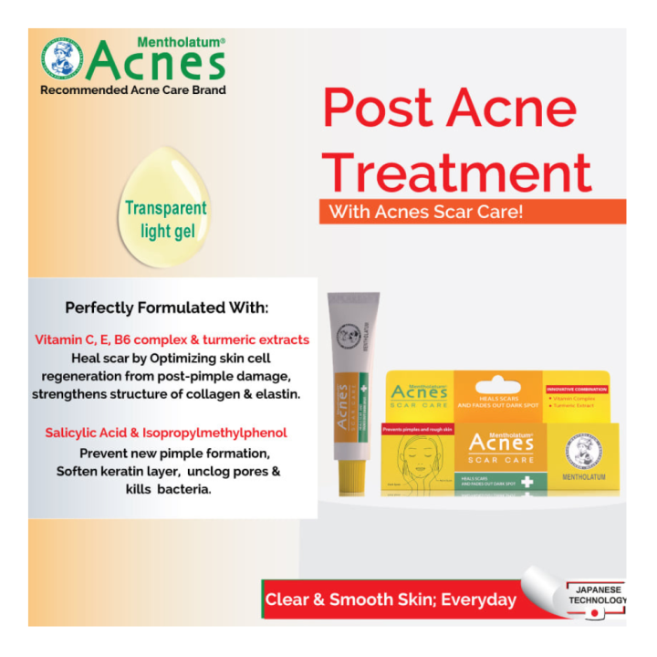 Acne%20Scar%20Care%20Removal%20gel%20%7C%20best%20scar%20gel%20for%20face%20%7C%20pimple%20mark%20remover%20%7C%20dark%20spot%20corrector%20%7C%20post%20acne%20treatment%20%7C%20acne%20scar%20cream%20Nepal%20%7C%20vitamin%20C%20for%20acne%20scars%20%7C%20turmeric%20scar%20care%20%7C%20acne%20scar%20solution%20%7C%20scar%20fading%20gel%20%7C%20acnes%20scar%20care%2012gm%20-%20Image%204