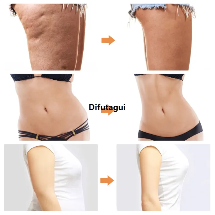 Difutagui%20Liposuction%20Machine%20Female%20Abdominal%20Trainer%20EMS%20VE%20Sport%20Belly%20Leg%202025%20Fat%20Burner%20In%20Order%20To%20Loss%20Weight%20Body%20Shape%20Anti%20Cellulite%20-%20Image%204