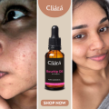 Cliara Rosehip Oil 10ml For All Skin Types. 