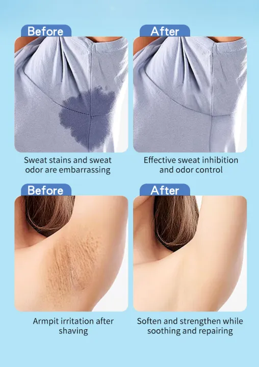 Dr%20Rashel%20Roll-On%20Deodorant%20%E2%80%93%2048H%20Sweat%20&%20Odor%20Protection,%20Quick%20Dry,%20Alcohol-Free,%20Underarm%20Roller%20%7C%20For%20All%20Skin%20Types%20-%2050ml%20-%20Image%204