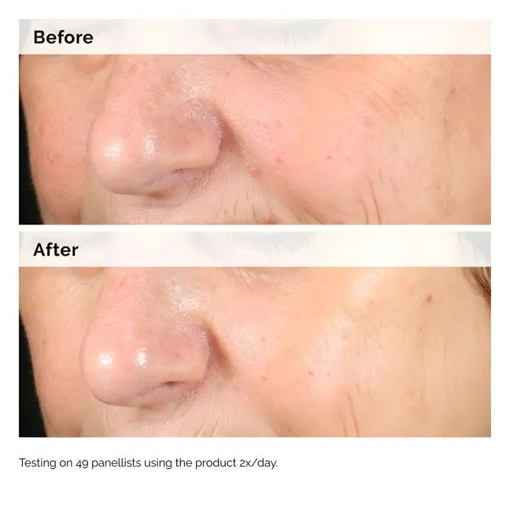 Ordinary%20Ascorbic%20Acid%208%25%20+%20Alpha%20Arbutin%202%25%20Serum%2030ml%20%E2%80%93%20Brightening%20&%20Pigmentation%20Care%20-%20Image%202