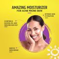 Acmist Moisturizing Cream Gel 50g / 100g with Squalene Vit E Aloe Vera - AcMist Moisturizer for Oily Skin and Acne Prone. 