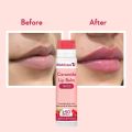 Wishcare Tinted Ceramide Lip Balm with SPF50 PA+++ - Kojic Acid & Niacinamide - For Lip Lightening 5gm. 