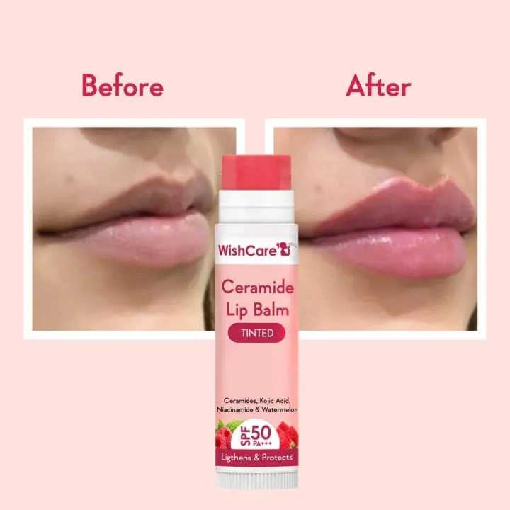 Wishcare%20Tinted%20Ceramide%20Lip%20Balm%20with%20SPF50%20PA+++%20-%20Kojic%20Acid%20&%20Niacinamide%20-%20For%20Lip%20Lightening%205g%20-%20Image%202