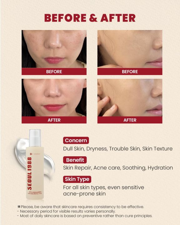 KSECRET%20Seoul%201988-Essence%20Snail%20Mucin%2097%25%20+%20Rice(100ml)%20By%20koreanbeautypoint%20-%20Image%204