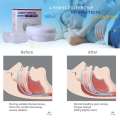 Anti Mouth Guard Adjustable Anti-Snoring Sleeping Devices Bruxism Snoring Stopper Improve Sleep Mouthpiece. 