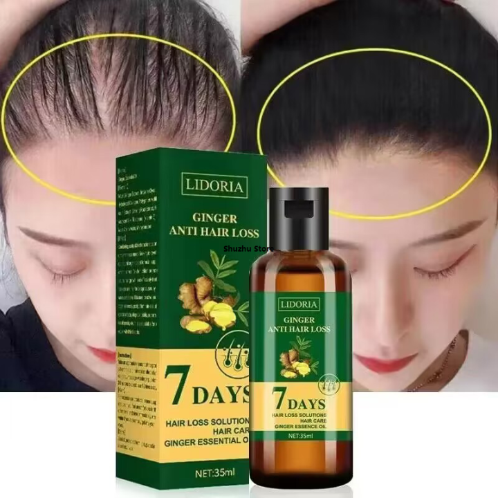 Shuzhu%20StoreOriginal%20Lethe%20Ling%20phone%20case%20Ginger%20Hair%20Growth%20Product%20Anti%20loss%20Hair%20Regrowth%20Serum%20Fast%20Growth%20Prevent%20Baldness%20Treatment%20Alopecia%20Hair%20Care%20Essential%20Oil%20-%20Image%202