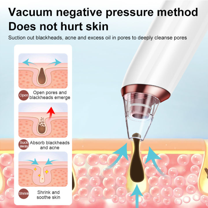 INSMART%20Electric%20Facial%20Blackhead%20Remover%20Vacuum%20Pore%20Cleaner%20Acne%20Cleanser%20Black%20Spots%20Removal%20Face%20Nose%20Deep%20Cleaning%20Tools%20-%20Image%204