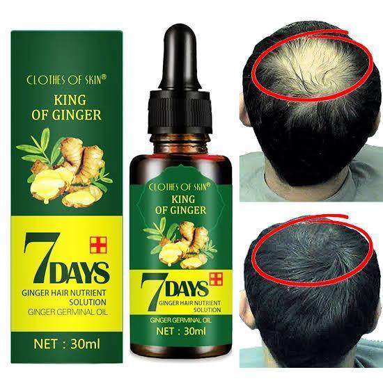 Hair%20Regrow%207%20Day,%20Ginger%20Germinal%20Essential%20Oil%20Hair%20Growth%20Hair%20Loss%20Treatment%20Hair%20Care%20Hair%20Growth%20Serum%20for%20Men%20&%20Women,%2030ml%20-%20Image%202