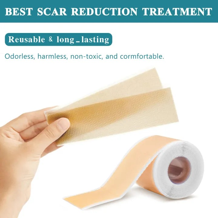 New%20model%201.5M/3M%20Scar%20Removal%20Patch%20Surgery%20Self-Adhesive%20Silicone%20Gel%20Tape%20Remove%20Scar%20Patch%20Sticker%20Acne%20Trauma%20Burn%20Scar%20Skin%20Care%20-%20Image%206