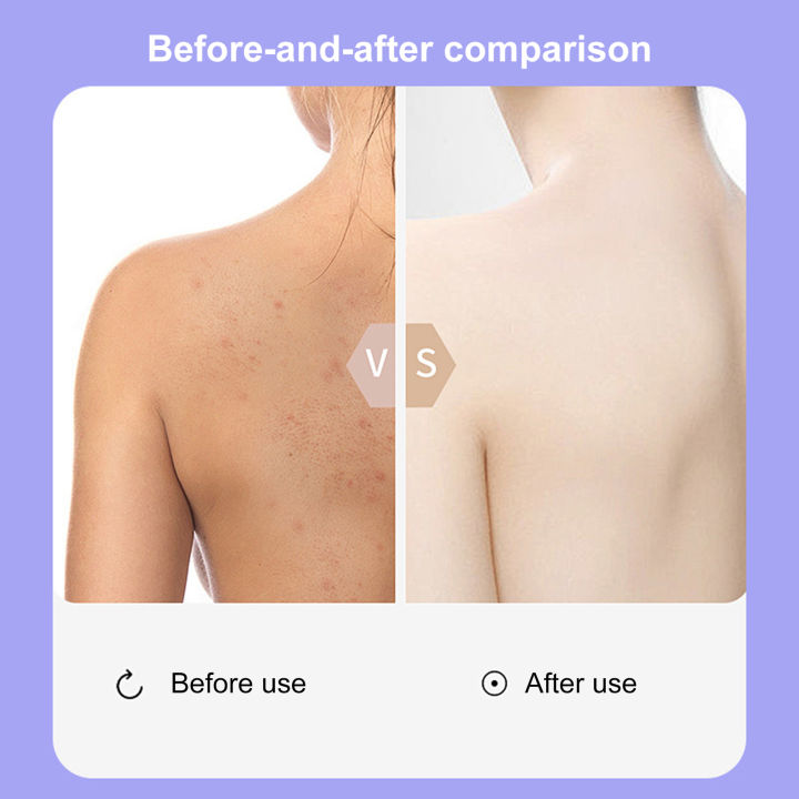 Likovie%20Silicone%20Shower%20Brush%20Silicone%20Body%20Scrubber%20Shower%20Brush%20Exfoliating%20Skin%20Deep%20Cleaning%20Bath%20Scrubber%20Ergonomic%20Grip%20Gentle%20for%20Smooth%20-%20Image%205