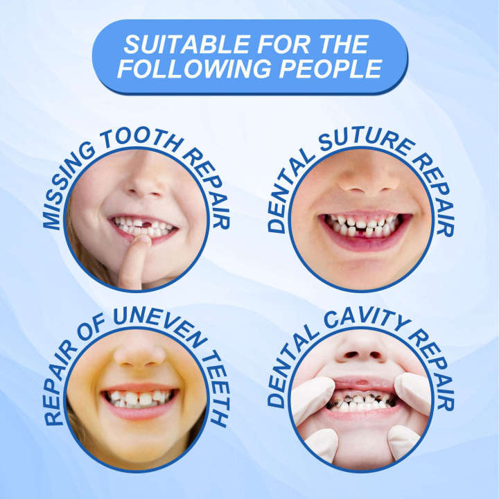 South%20Moon%20Solid%20Teething%20Temporary%20Tooth%20Repair%20Cavity%20Filling%20Gel%20Denture%20Gap%20Filler%20-%20Image%204