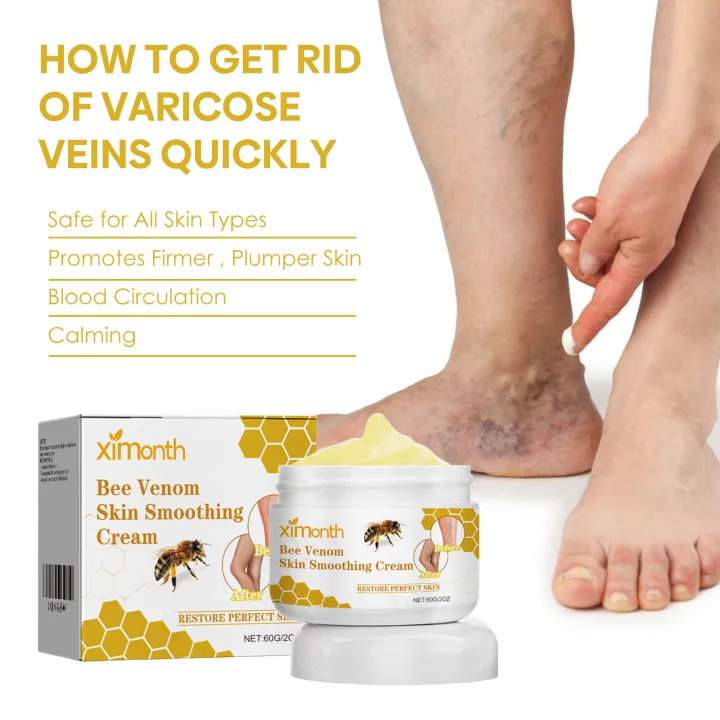 Ximonth%2060g%20Bee%20Venom%20Skin%20Smoothing%20Cream%20Repair%20Vein%20Varicose%20Promotes%20Blood%20Circulation%20Reduce%20Spider%20Veins%20Leg%20Care%20Paste%20-%20Image%202