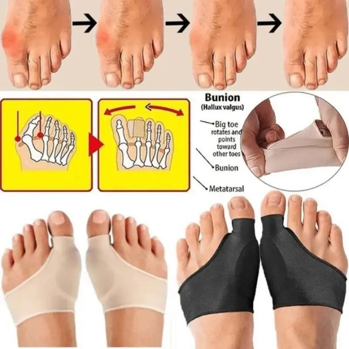 1 Pair Super Elastic Bunion Sleeve Bunion Corrector Protector PreventHallux Valgus - Foot Caring Toe Corrector